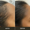 Escova de Terapia Capilar