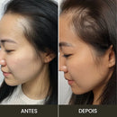 Escova de Terapia Capilar