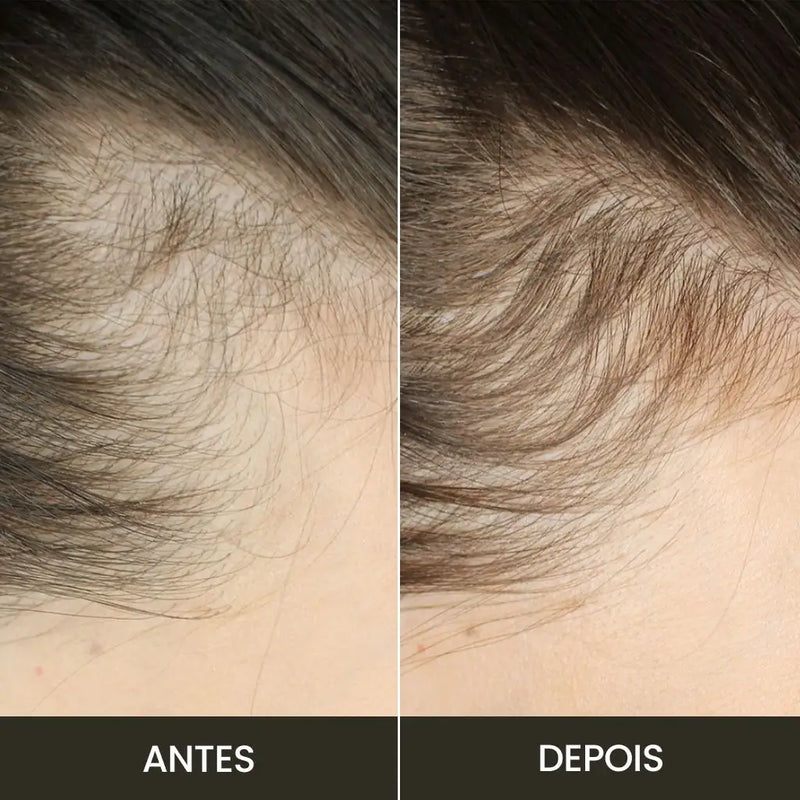 Escova de Terapia Capilar